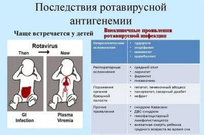 Как проявляется ротавирус у грудных детей