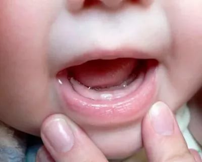 Сколько времени прорезается первый зуб у ребенка