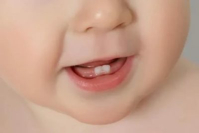 Когда начинаются зубы у грудничков