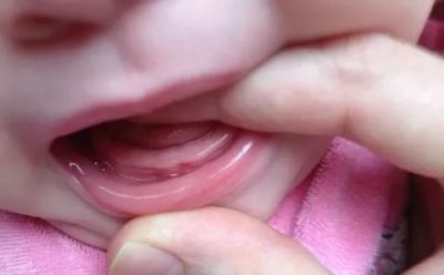 Когда режутся первые зубы у младенцев