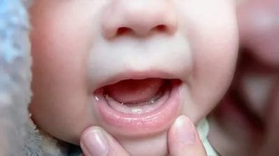 Какой первый зуб вырастает у ребенка