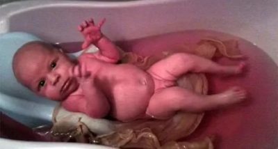 Можно ли купать новорожденного в марганцовке