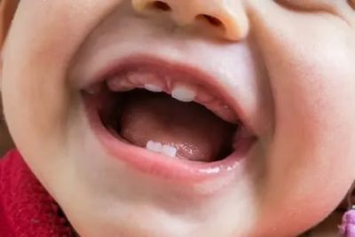 Когда у ребенка начинают резаться зубы