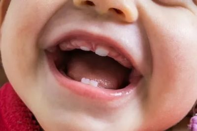 Какой первый зуб вырастает у ребенка