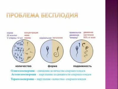 Как можно узнать о бесплодии