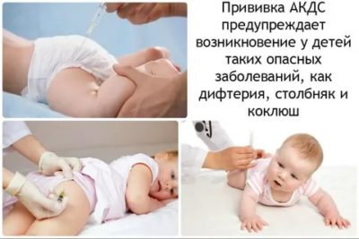 Куда делают прививку Акдс ребенку